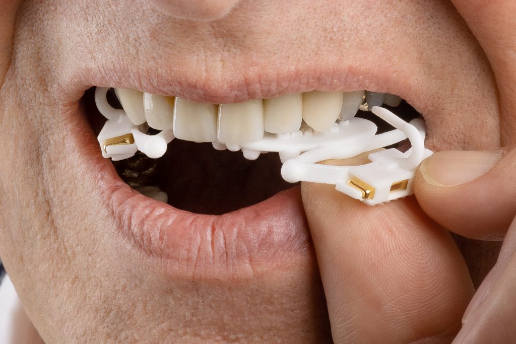 Schnarchspange oder CPAP-Gerät – was hilft wirklich gegen Schnarchen?