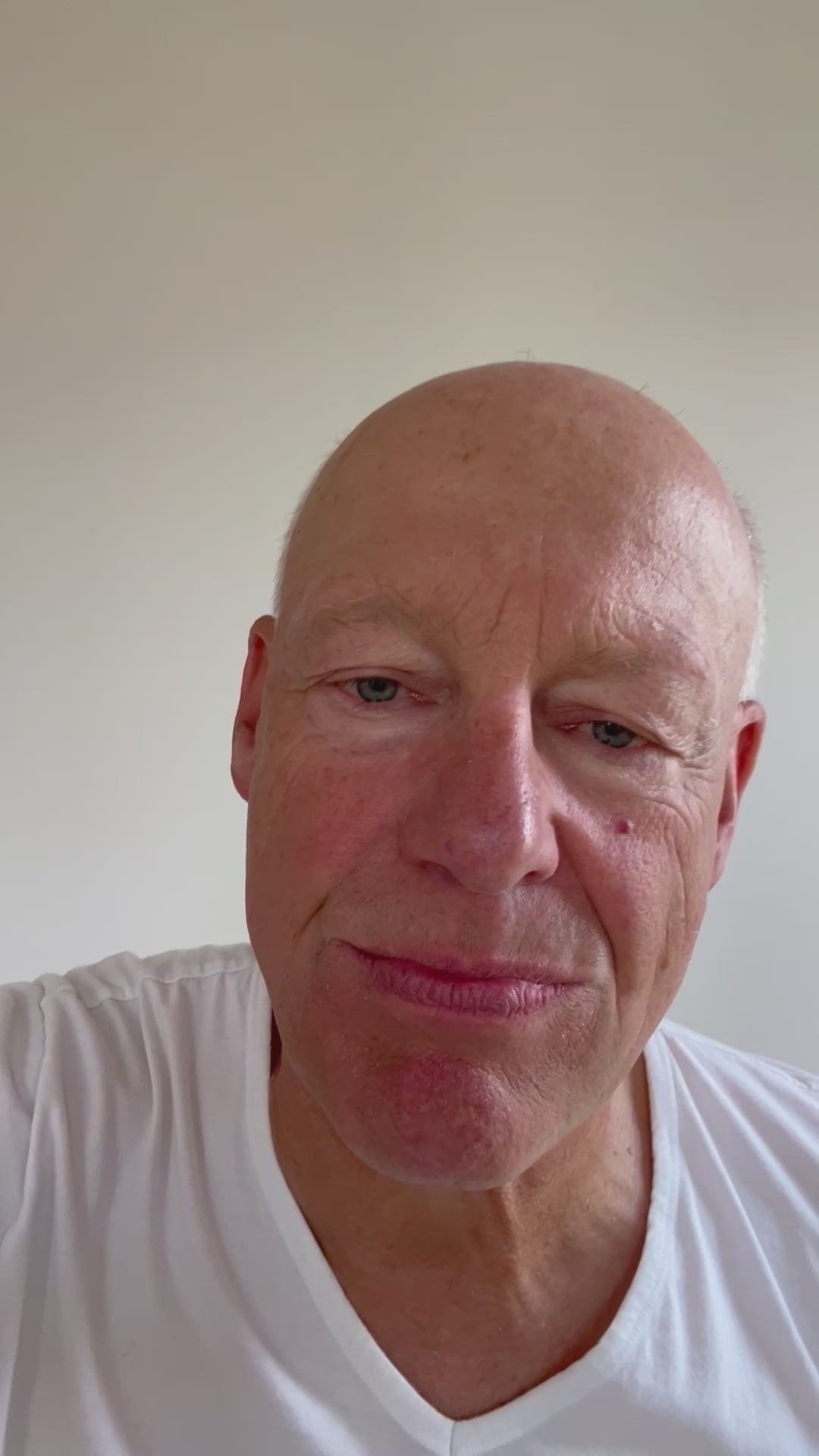 Video laden: EVERYBODY - Schnarchspange - Freies Atmen im Schlaf